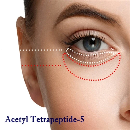 Acetyl Tetrapeptide-5 RD นวัตกรรมและการประยุกต์ทางคลินิก